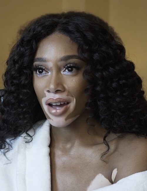 Winnie Harlow
